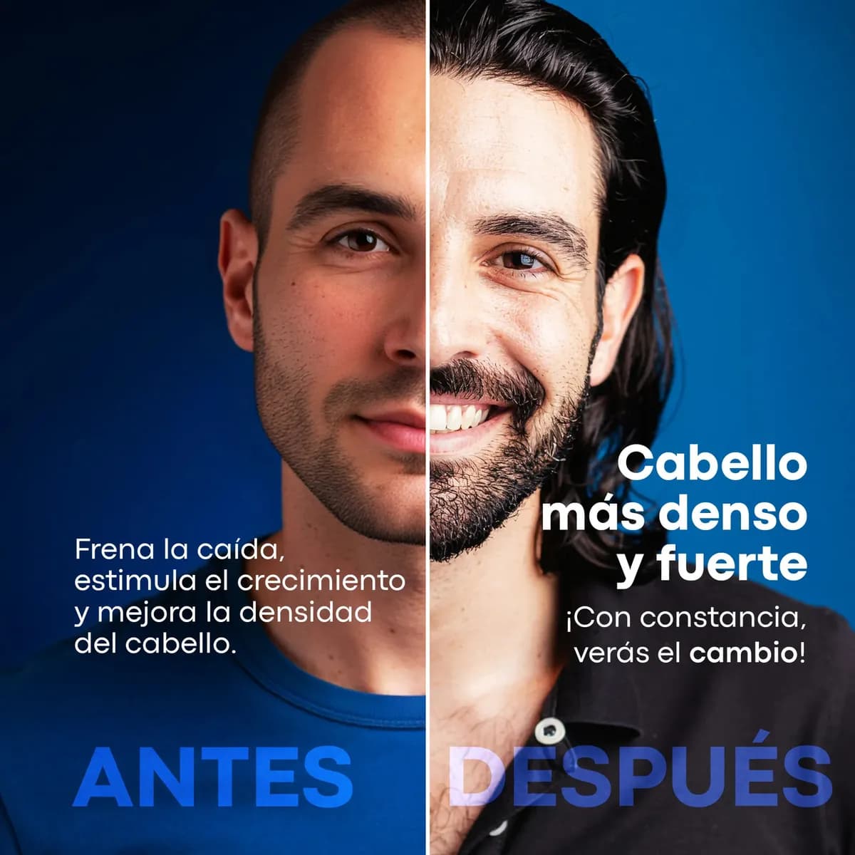 Minoxidil 5% Anacastel 3x2 Pack Tratamiento Anticaida Crecimiento de Cabello, Barba y Bigote