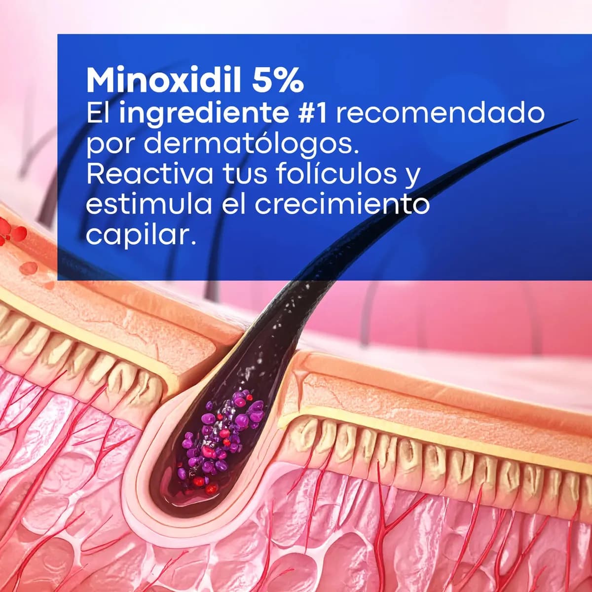 Minoxidil 5% Anacastel 3x2 Pack Tratamiento Anticaida Crecimiento de Cabello, Barba y Bigote